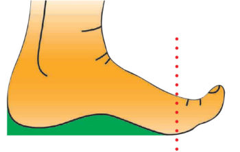 Orthotic Selection – ICB Medical